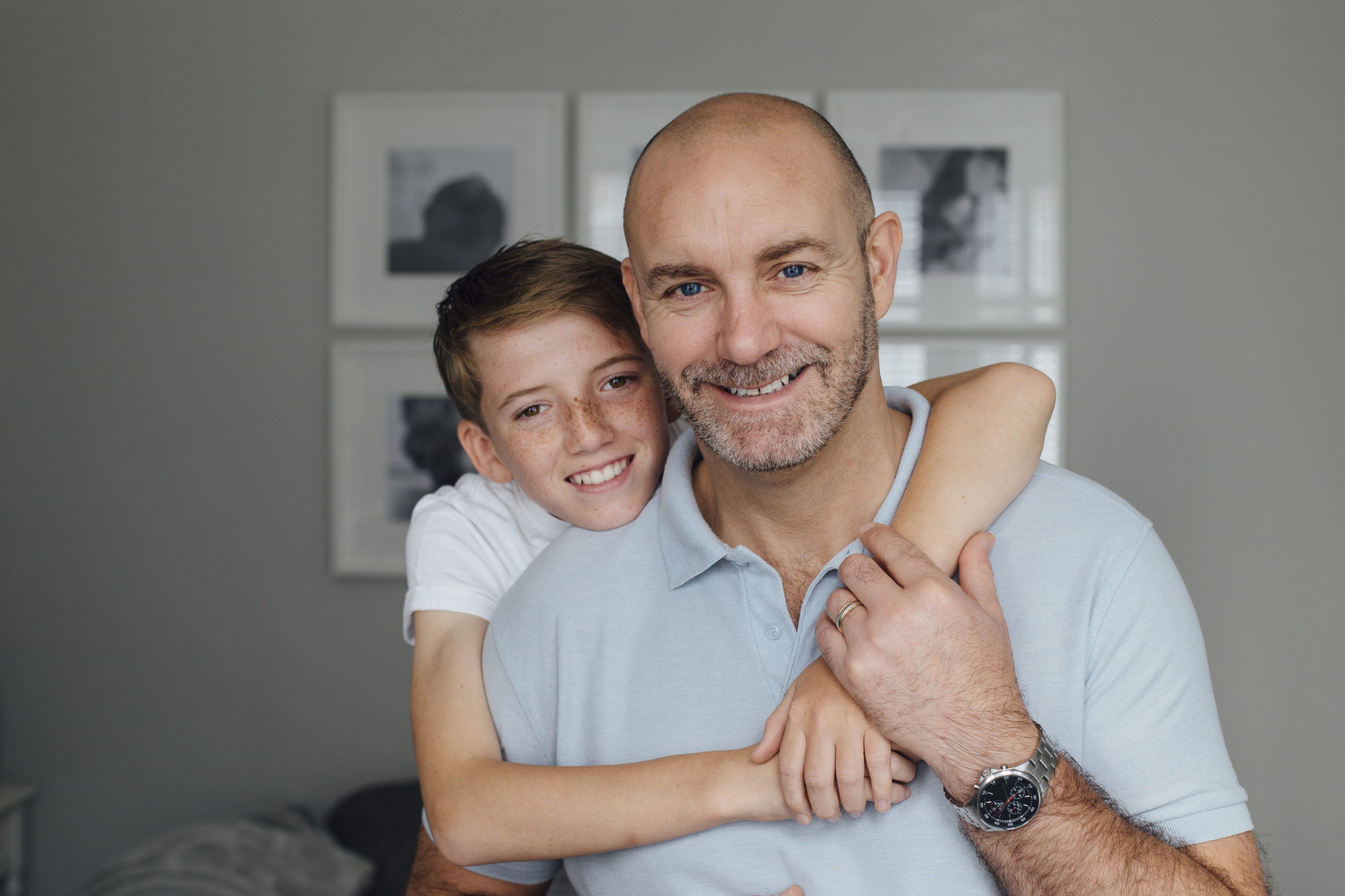 Hair Loss - Glick Skin Institute