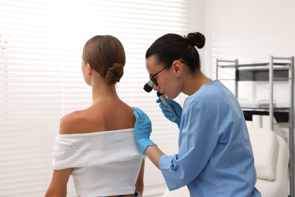 melanoma